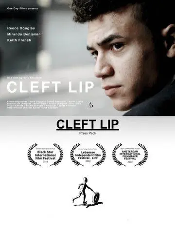 Постер: Заячья губа / Cleft Lip (2017)